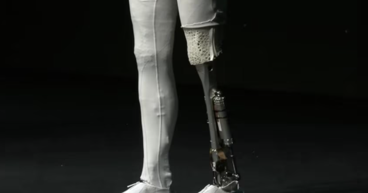 robot leg human